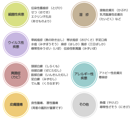 皮膚病の代表的な疾患